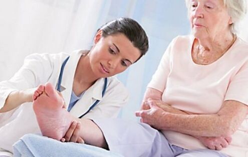 Suchen Sie einen Arzt auf, wenn Sie Symptome von Krampfadern haben